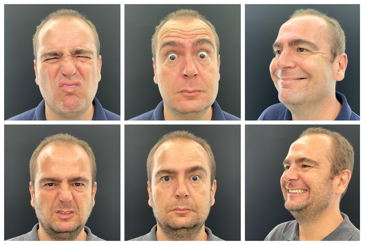 Eu já fiz botox duas vezes, mas não parece (e essa é mesmo a ideia) 